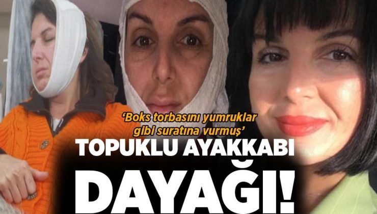 Güzellik salonunda topuklu ayakkabı dayağı! ‘Boks torbasını yumruklar gibi suratına vurmuş’