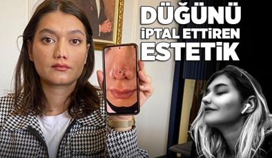 Düğünü iptal ettiren estetik! Doktordan skandal sözler: Sen de ne kadar şanssızsın